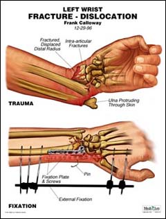 Sample of a Medi-Lex Display 